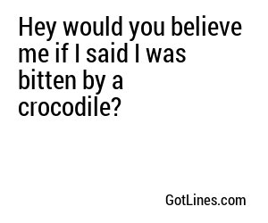 Hey would you believe me if I said I was bitten by a crocodile?
